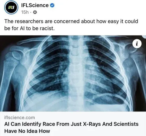 AI Identifies Race From X-Rays