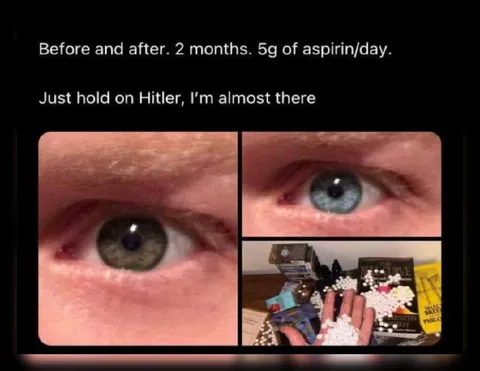 Before and After Aspirin Eyes