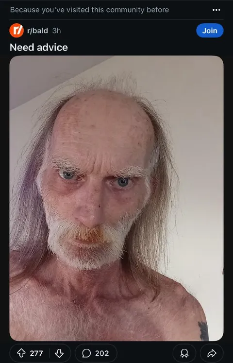 Need Advice Bald Man Selfie