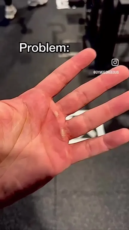 Problem Hand, Cat Solution