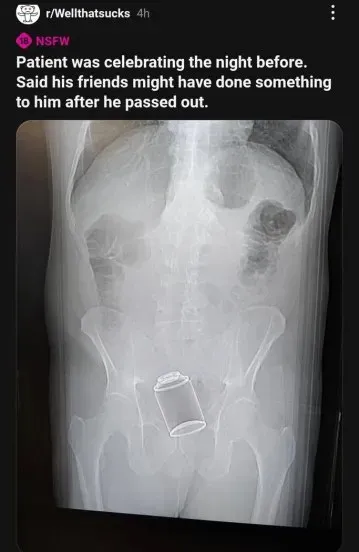 Friends' Prank After Passing Out