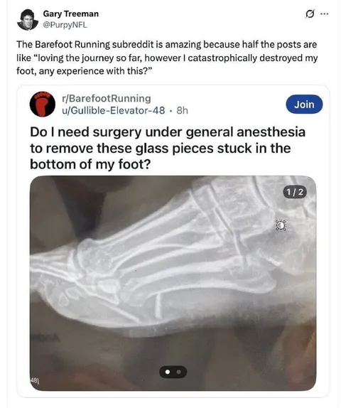 Barefoot Running Glass Foot