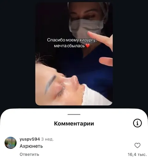 Мечта о носе сбылась