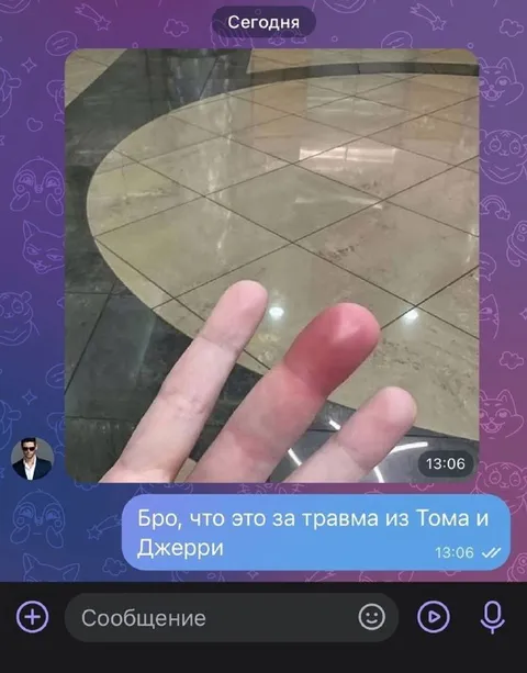 Травма из Тома и Джерри
