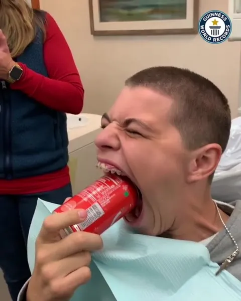 Самый большой рот