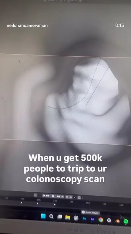 500k People Trip at Colonoscopy