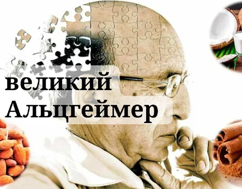 Великий Альцгеймер