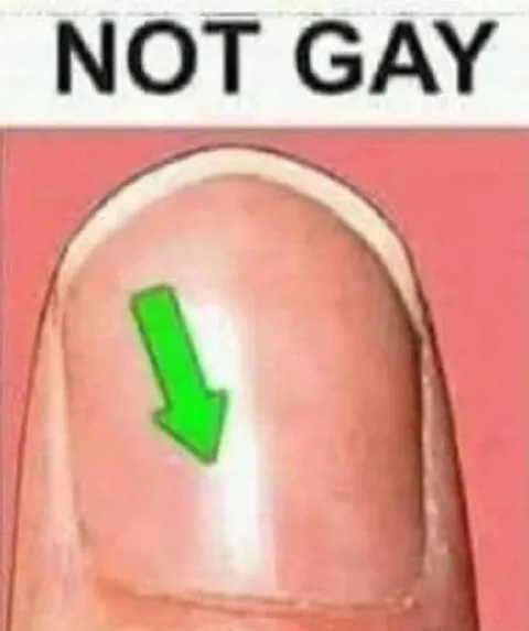Not Gay Fingernail