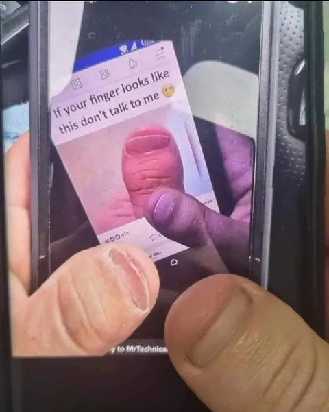 If Your Finger Looks Like This