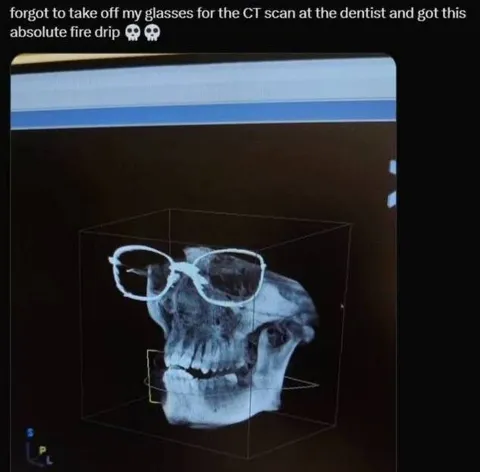 CT Scan Glasses Drip