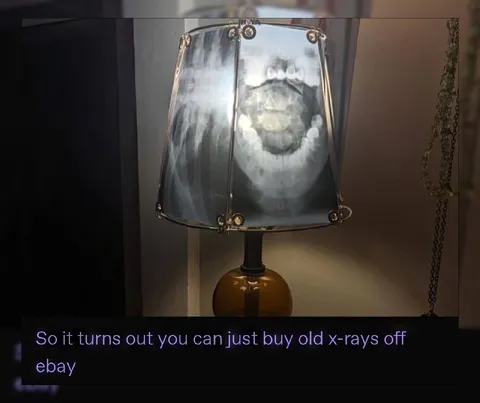 Buying Old X-Rays on eBay