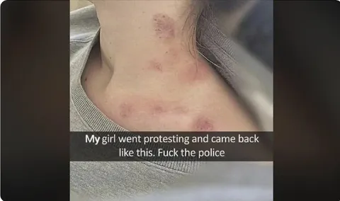 My Girl Went Protesting