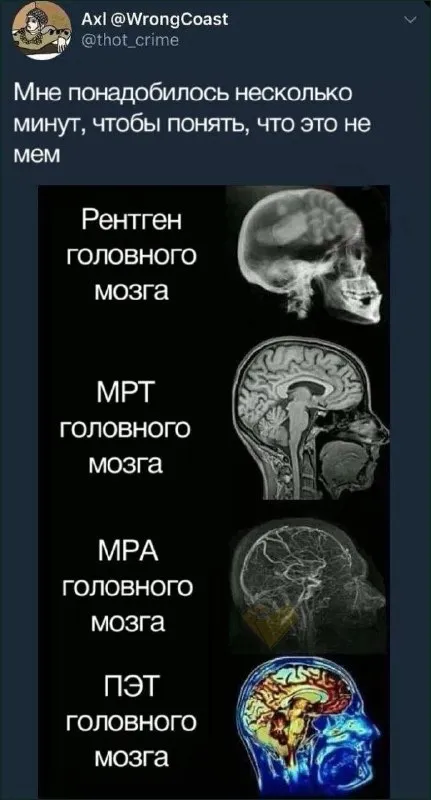 Это не мем, а снимки мозга