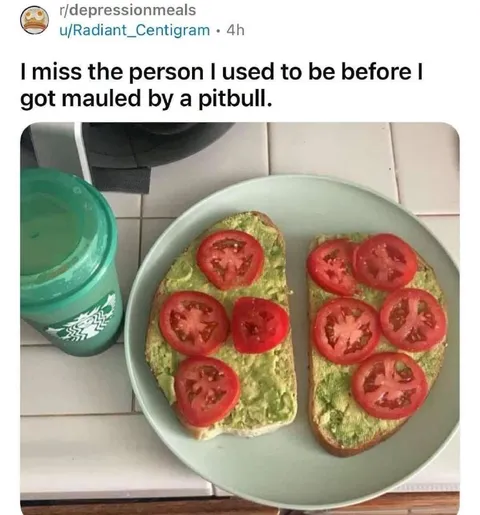 Mauled by a Pitbull