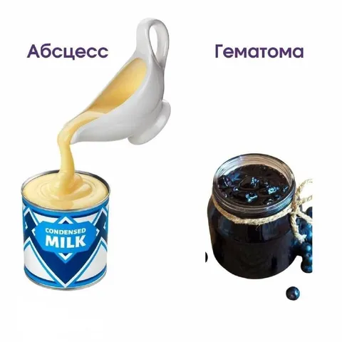 Абсцесс и гематома