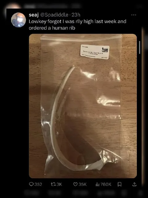Accidentally Ordered a Human Rib