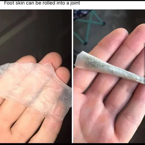 Foot Skin Joint