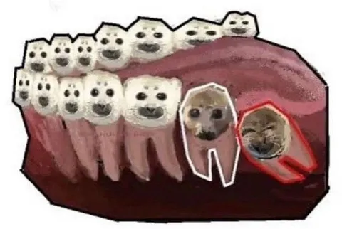 Зубы среди чужих
