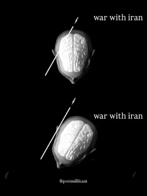 War With Iran Brain Scan