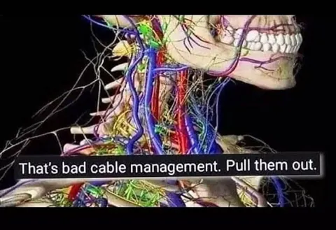 Bad Cable Management Anatomy