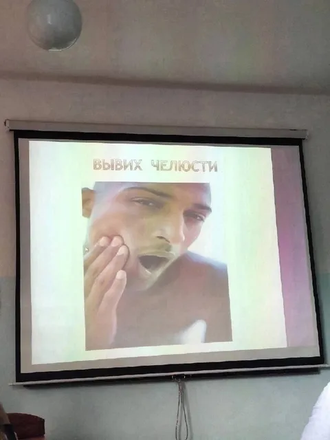 Вывих челюсти на презентации