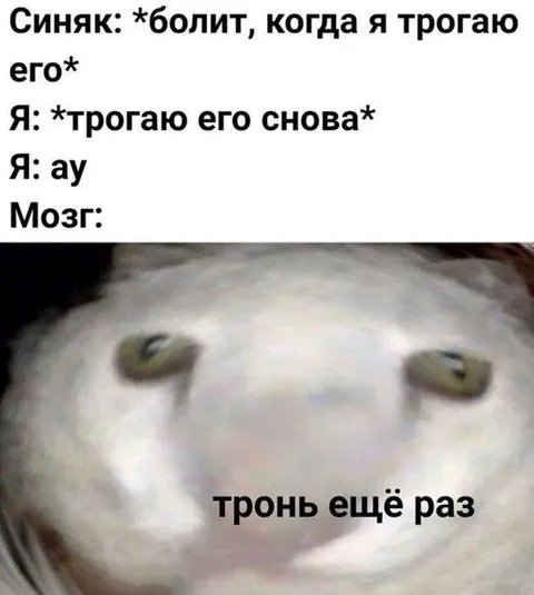 Синяк: тронь ещё раз
