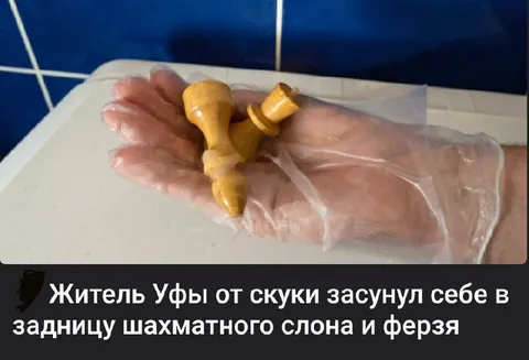 Шахматные фигуры в заднице