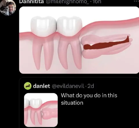 What Do You Do in This Situation
