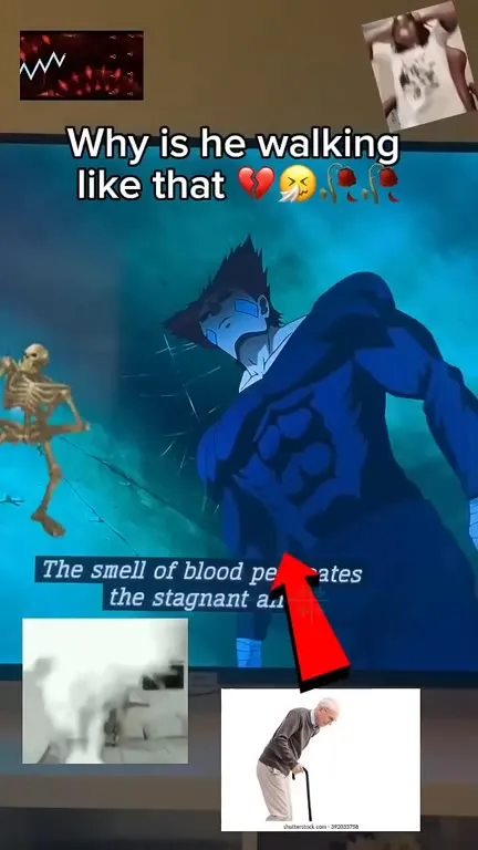 Why Is He Walking Like That