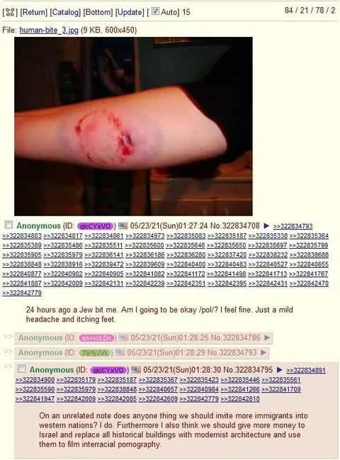 A Jew Bit Me