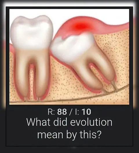 Evolution Made Wisdom Teeth Worse