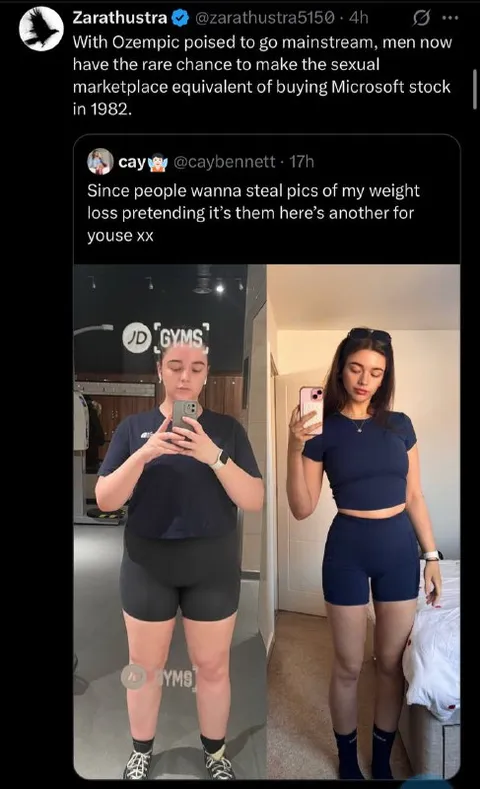 Ozempic Weight Loss Transformation