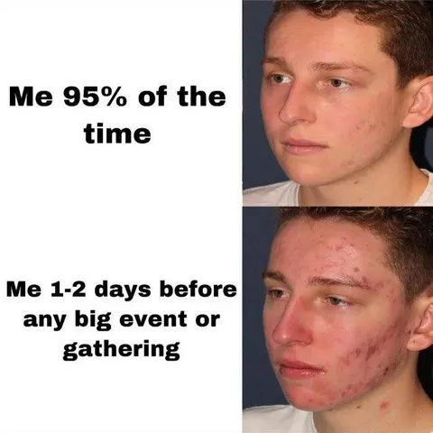 Me Before Any Big Event