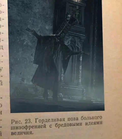 Горделивая поза больного шизофренией