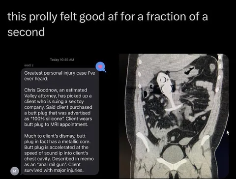 Anal Rail Gun MRI Accident