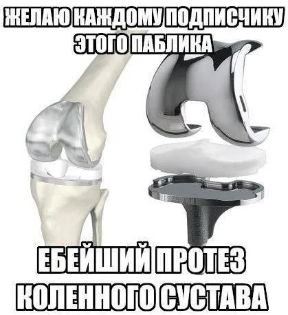 Протез коленного сустава подписчикам