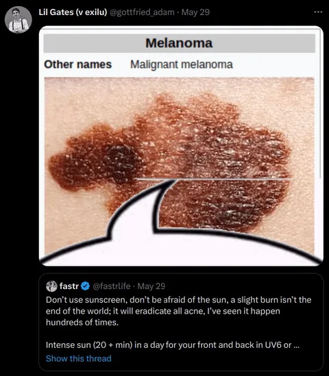 Melanoma Loves the Sun