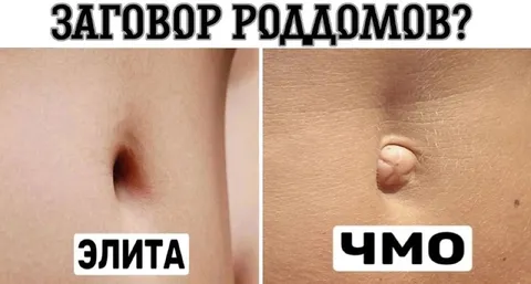 Заговор роддомов и пупки
