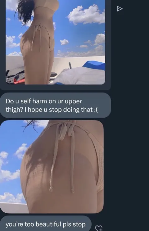 Too Beautiful to Self-Harm