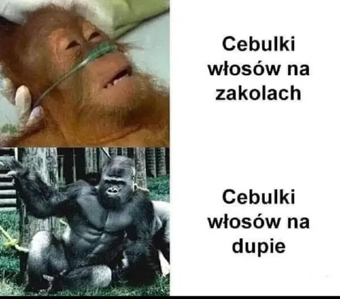 Cebulki włosów na zakolach i dupie