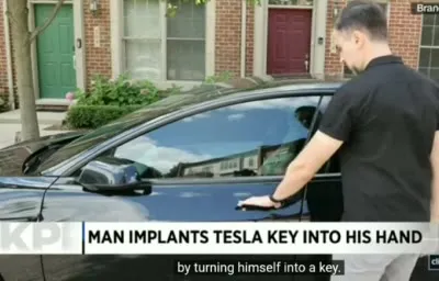 Man Implants Tesla Key in Hand