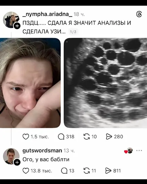 Сдала анализы и сделала УЗИ