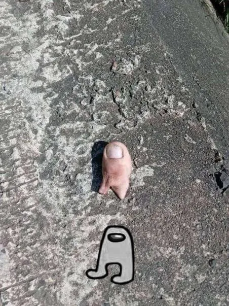 Палец стал амогусом