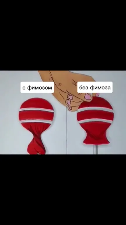 Леденец без фимоза атакуют мухи