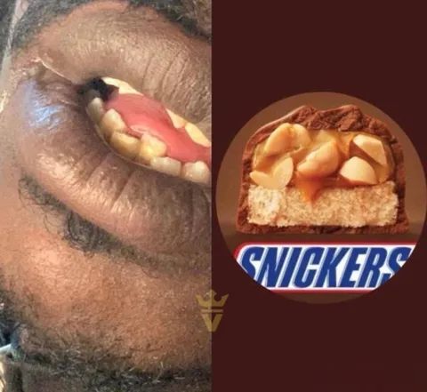 Snickers вместо улыбки