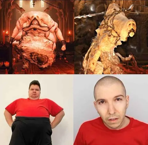 До и после похудения