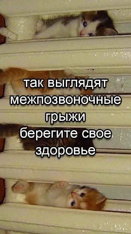 Так выглядят межпозвоночные грыжи