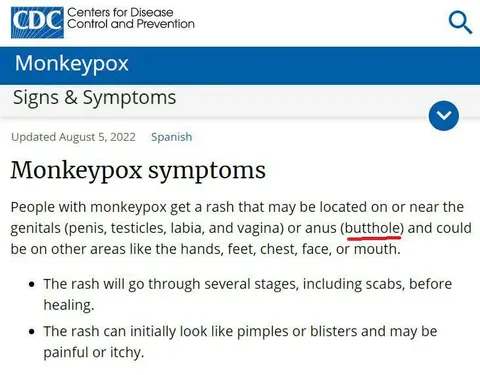 Monkeypox Symptoms Butt Hole