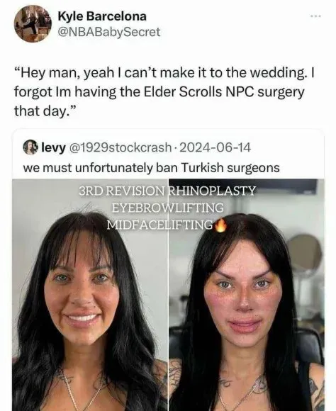 Elder Scrolls NPC Surgery