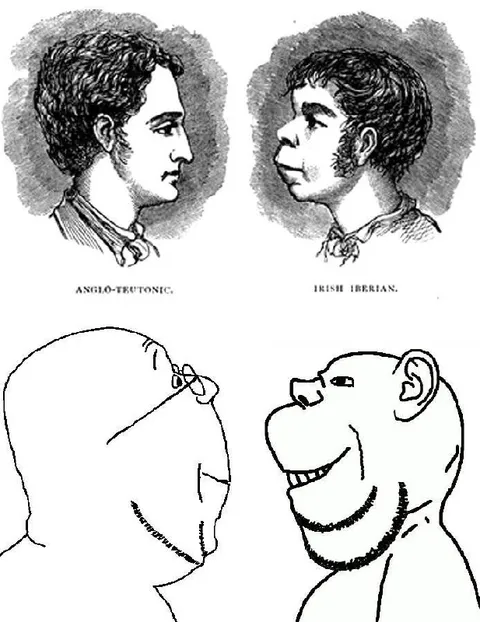 Anglo-Teutonic vs Irish Iberian